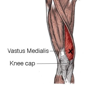 vastus medialis trainieren kniebeschwerden reduzieren